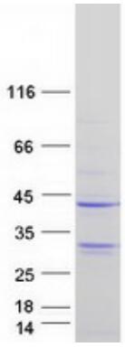 Coomassie blue staining of purified MS4A1 protein.